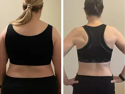 Body Recomposition, Los Angeles, CA